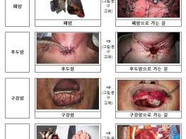 보건복지부, 연말부터 담뱃갑에 새로운 경고그림이 표기됩니다 기사 이미지